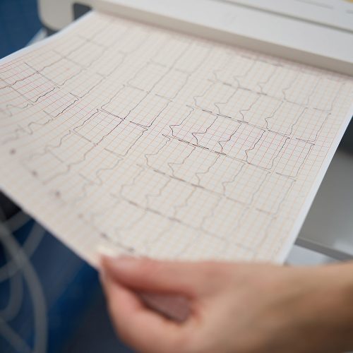 Kardiologe-Baden-EKG